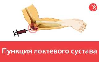 Пункция локтевого сустава